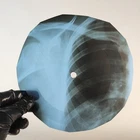 DAVID BOWIE BLACK COUNTRY ROCK X-Ray USSR Record Roentgen Bone Ribs Music Vinyl