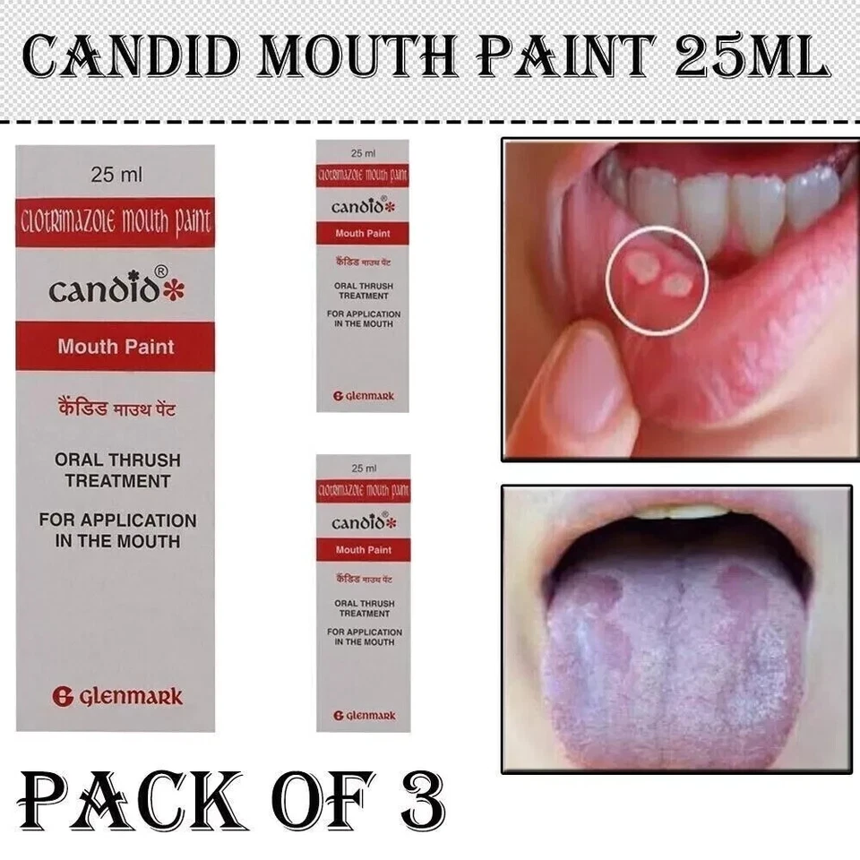 GLENMARK 3 X Candid Mouth Pain For Oral Thrush Treatment For Kills Fungal Infection