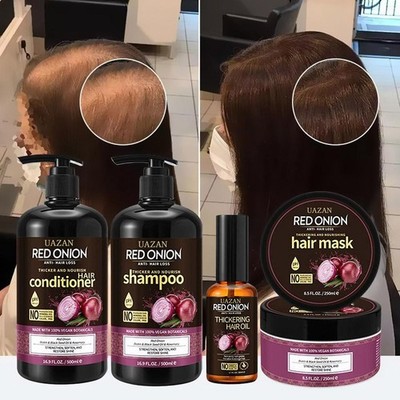 RED Onion Thickering Hair Oil / Mask / Conditioner / Loss Anti-hair Shampoo W6Y5