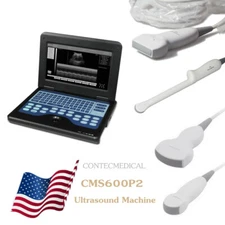 Portable Ultrasound Scanner Laptop Machine Convex Linear Transvaginal Probe