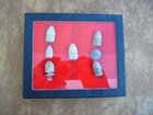 Lot Of 7 Dug Civil War Bullets at Gettysburg PA