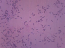 Sperm Smear - Prepared Microscope Slide - 75x25mm - Eisco Labs