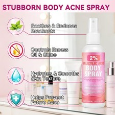 2 Salicylic Acid Spray, 360 Acne Spray, All Skin Types, 5.07 fl.oz