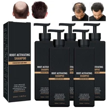 5x Spartan Shampoo,Spartan Root Activator Shampoo,Natural Hair Regrōwth Shampoos