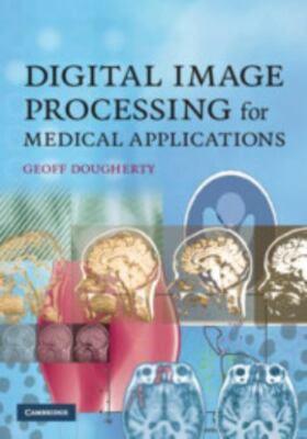 Digital Image Processing for Medical Applications by Dougherty, Geoff