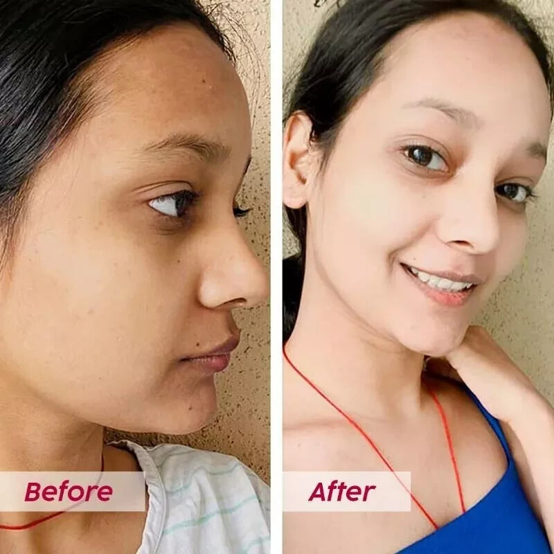 PLIX Skin Glow Glutathione Effervescent Tablets For Clear And Youthful Skin  | eBay