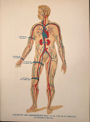 1901 Antique Medical Human Anatomy Litho Print What to do if bitten by Mad Dog