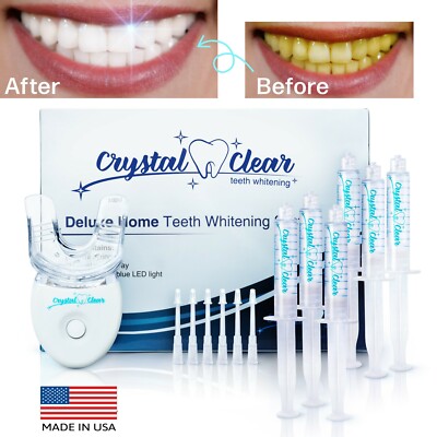 Blanqueador De Dientes Laser Gel KIT Profesional Dientes Blanqueamiento Dental