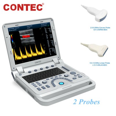 CMS1700B Portable Color Ultrasound Scanner Color Doppler Linear Convex 2 probes