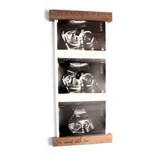 Sonogram Picture Frame Magnetic Ultrasound Keepsake Baby Love at First Sight ...