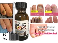FUNGUS athletes foot PLUS NAIL FUNGUS WONDERFUl support FOR NAILS 30mls