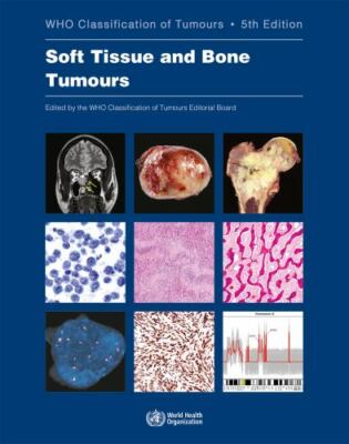 Soft Tissue and Bone Tumours (Medicine), , WHO Classification of Tumours Editori