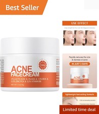 Natural Acne Spot Treatment Cream for All Skin Types - Fast Results in Days