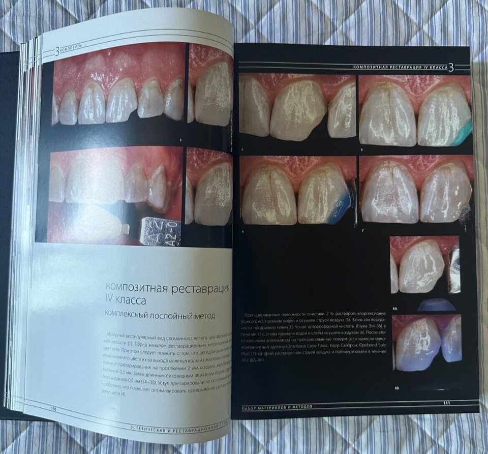 Esthetic & Restorative Dentistry Douglas A.Terry, Willi Geller /Russian