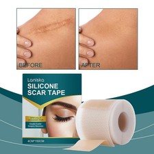 Silicone Scar Sheets,Silicone Scar Tape,Silicone Sheets For Scars BEST GOOD Q5J3