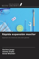 Rachna Jangu (U. A.) | RáPida ExpansióN Maxilar | Taschenbuch | Spanisch (2022)