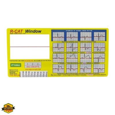 EKG Window 2nd Edition