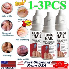 Fungi-Nail Anti-Fungal Liquid Solution Kills Fungus That Can Lead To Nail