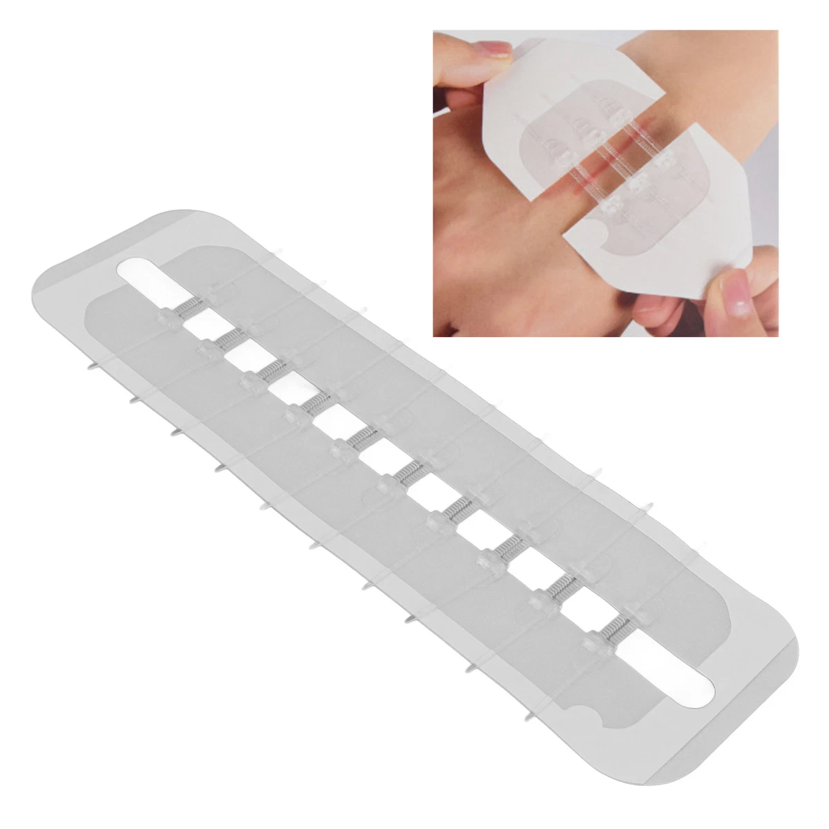 10pcs Emergency Wound Closures Surgical Laceration Repair