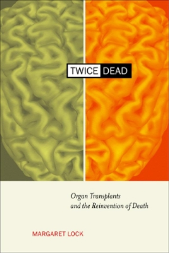 Margaret M. Lock Twice Dead (Tascabile) California Series in Public Anthropology