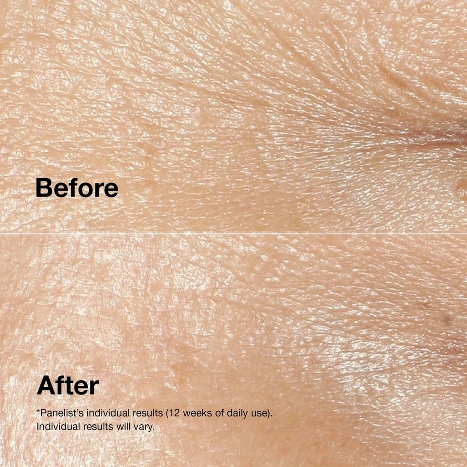 Clinique Smart Clinical Repair Wrinkle Correcting Cream 5ml Travel Size - Image 3 of 4