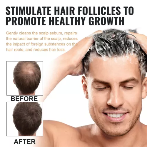1-5X Root Activator Shampoo, SPARTAN Hair Loss Shampoo,Shampoo Root Activator - Picture 4 of 9