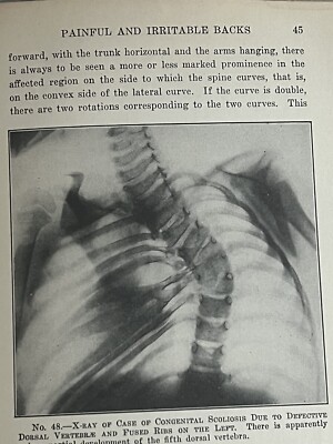 The PRINCIPLES Of ORTHOPEDIC SURGERY For NURSES 1st ed 1924 ? James Warren Sever