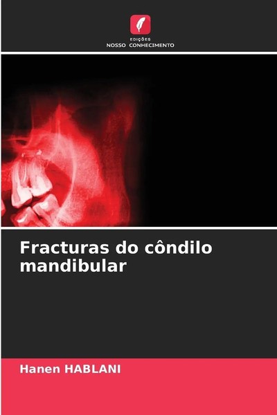 Hanen Hablani | Fracturas Do CôNdilo Mandibular | Taschenbuch | Portugiesisch-image