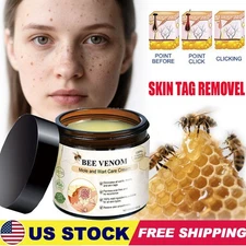 Bee Venom Skin Tag Removal Treatment Cream Body Care Mole Corn Wart Remover