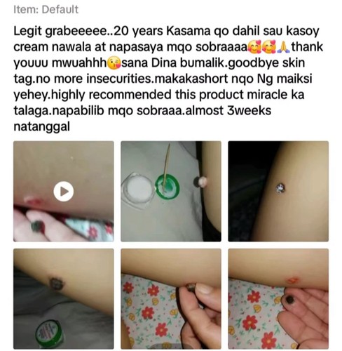 Nature's Miracle Kasoy Cream Remover 5g - Picture 7 of 10