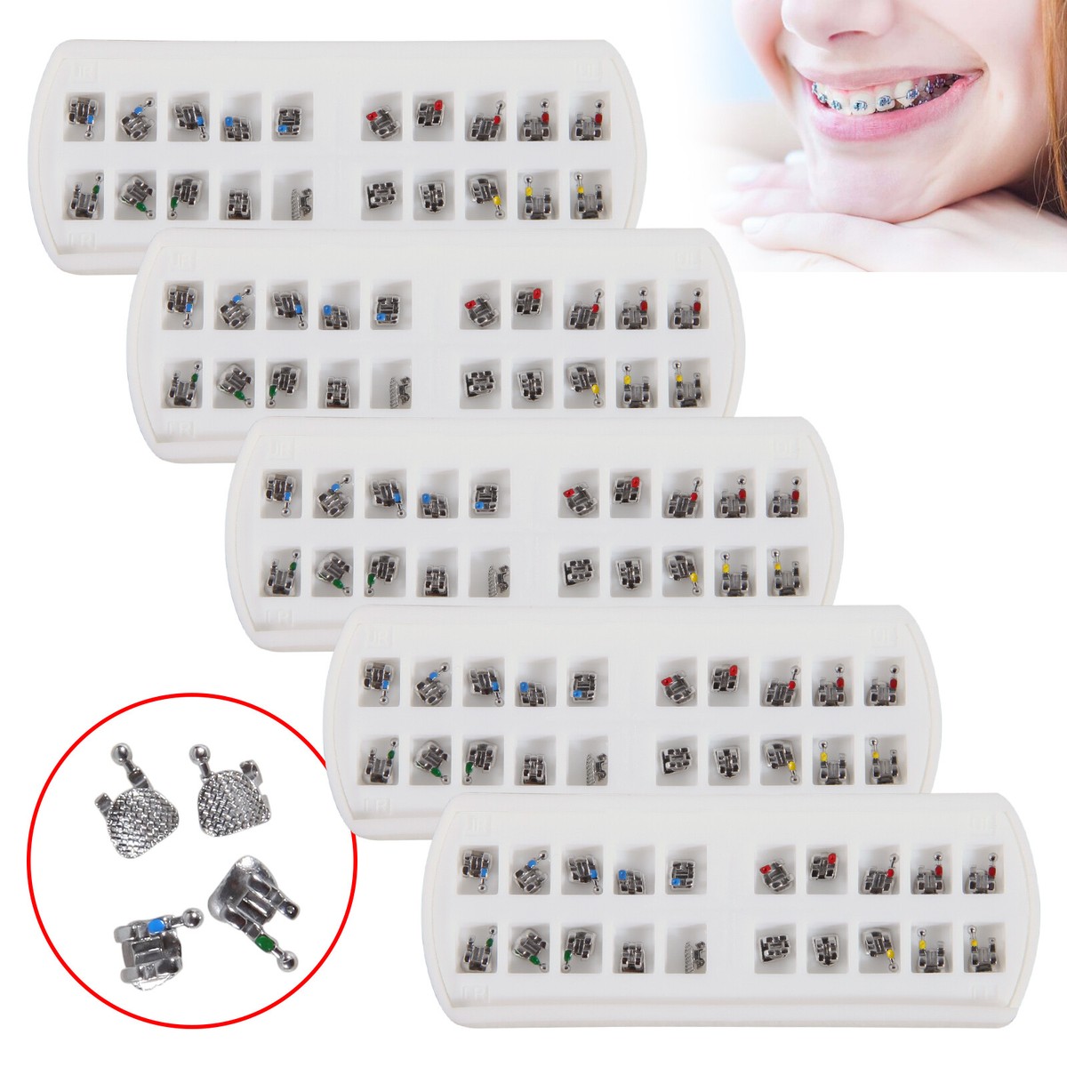 Bretelle In Ceramica: Foto Di Un Sistema Di Staffe In Ceramica, Prima E - Foto 4