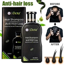 200ml DEXE Fast Hair Growth Shampoo Anti Hair Loss Hair Thickening For Women Men