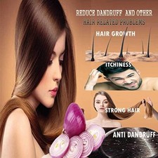 Amueroz Onion Black Seed Hair Oil for Hair Growth, Anti Hair Loss  Anti Dandruf