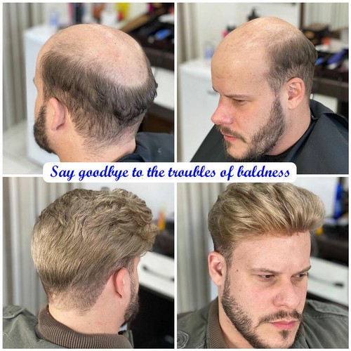 Thin 100% Human Hair Men Toupee Forehead Topper Hairpiece Wig Replacement System - Picture 3 of 51