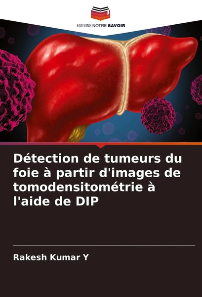 Rakesh Kumar Y | DéTection De Tumeurs Du Foie à Partir D'images De...-image