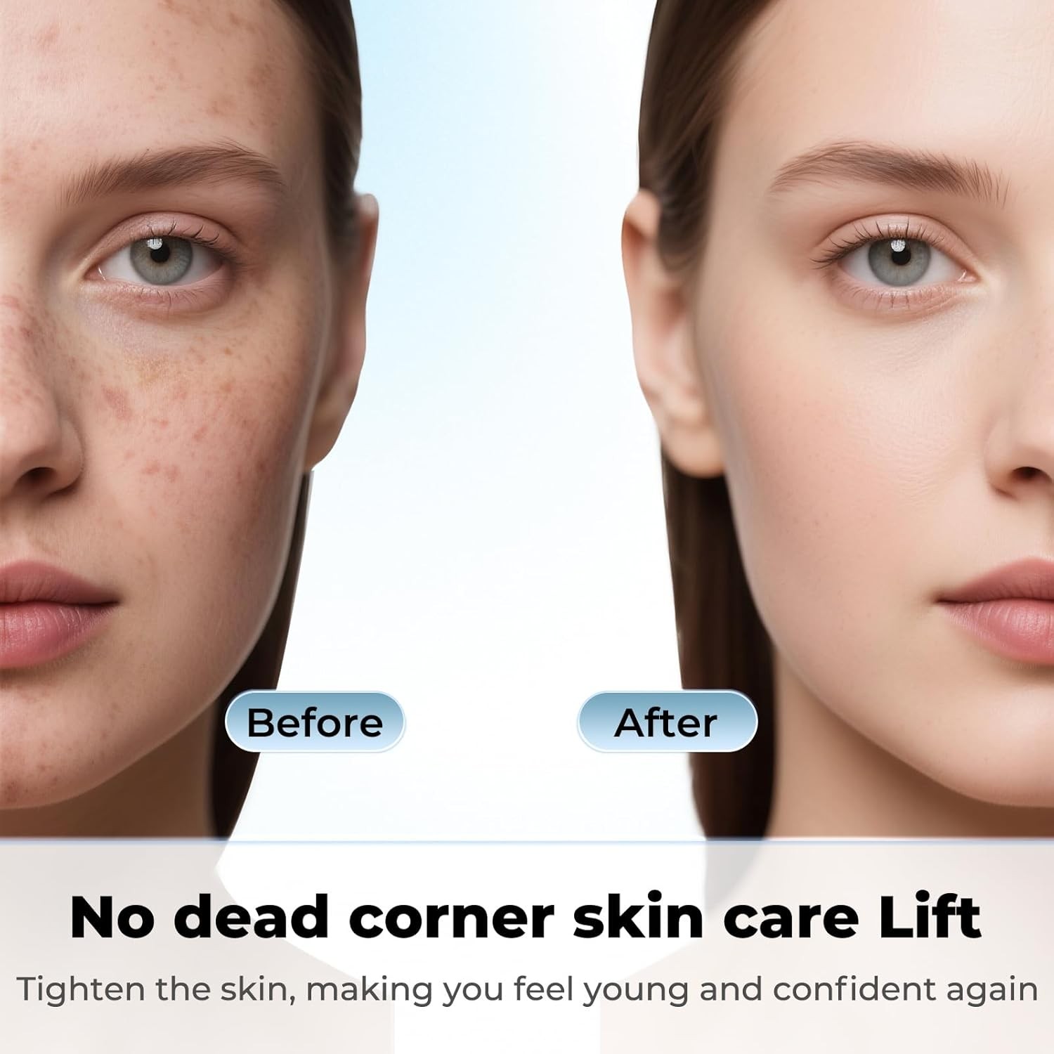 Blackhead Remover Tool Face Scrubber: PETYDOOT Double-Headed Green 