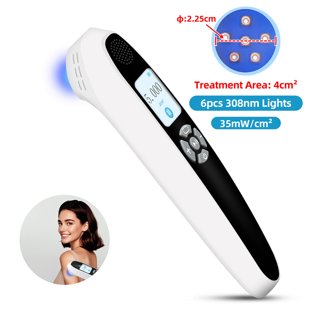 ALTRA 308nm Sistema Eccimeri Lampada UV Blu Dispositivo Terapia Ultravioletti per Malattie della Pelle W