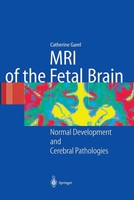 MRI Of The Fetal Brain Normal Development And Cerebral Pathologies C. Garel Buch