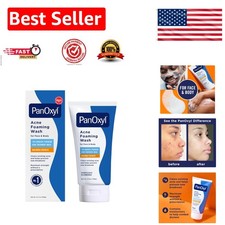 Maximum Strength 10 Benzoyl Peroxide Foaming Wash, 5.5 Oz - Treats Acne Fast