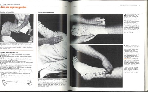 Dealing With Emergencies Nursing Photobook 1980 Resuscitation Burn Care Neonatal - Picture 11 of 13