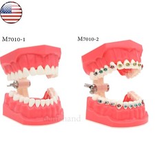 US Dental Typodont Teeth Model with Orthodontic Brackets Brushing