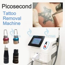 Pico Laser Tattoo Sopts Removal Machine Picosecond Laser Freckle Treatment