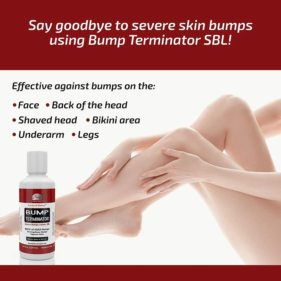 Loção Bump Terminator Severe Bumps - Tratamento de cabelo encravado para barbear - Unissex - Imagem 3 de 4