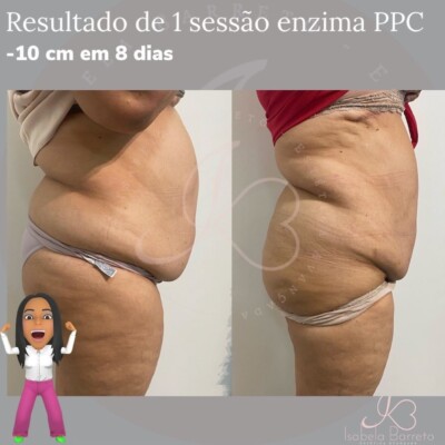 MESOLIPO PPC Cream Monnaskin 50g