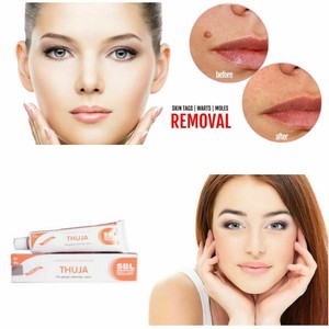 thuja ointment for pimples