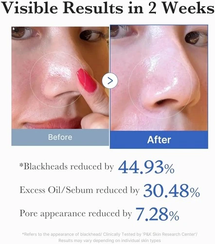 MediCube Zero Pore Pad 2.0 | Dual-Textured Exfoliating Toner Pads,Pore Refining - Picture 5 of 9