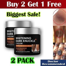 Dark Knuckle Finger Elbow and Knee Strong Whitening Cream For Removing