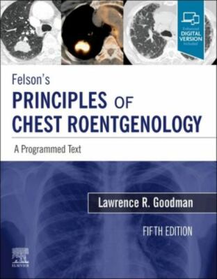 Felson's Principles of Chest Roentgenology, a Programmed Text: A Programmed Text
