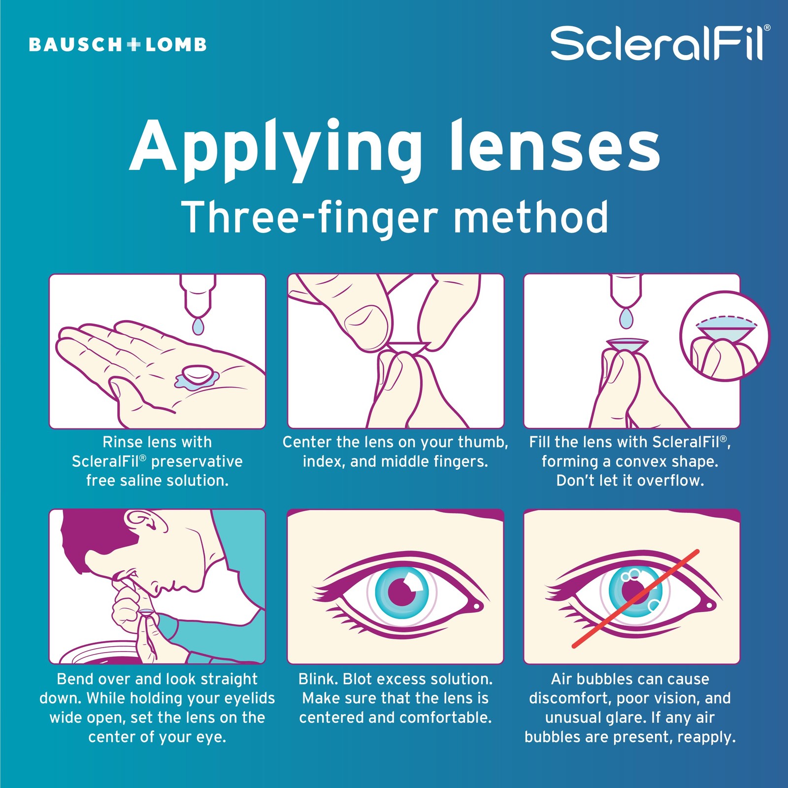 Scleralfil Saline Solution For Scleral, Soft, & Rigid Gas Permeable Le