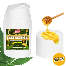  Raw Manuka Honey Healing Eczema cream - Psoriasis Good For Forehead